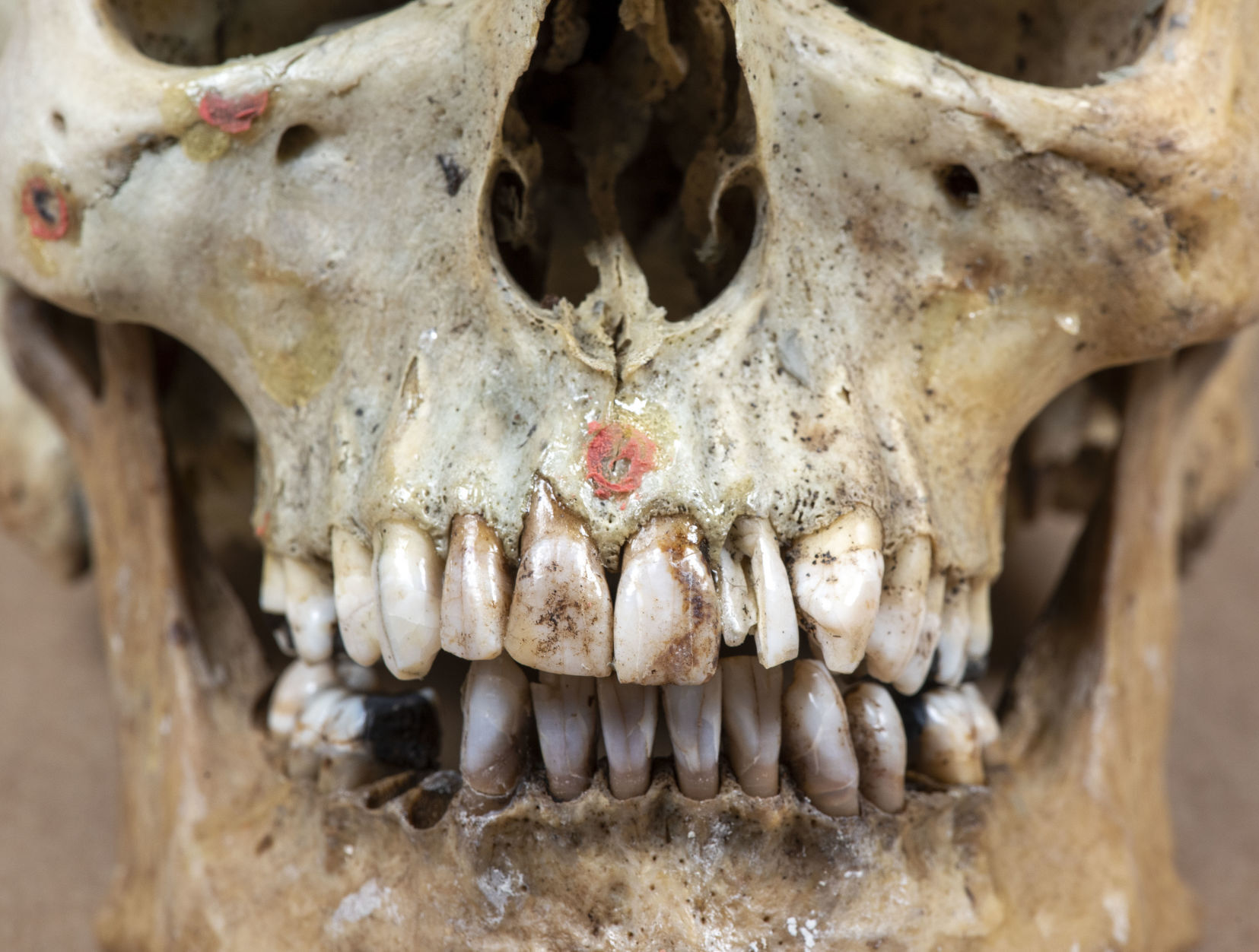 Unidentified remains
